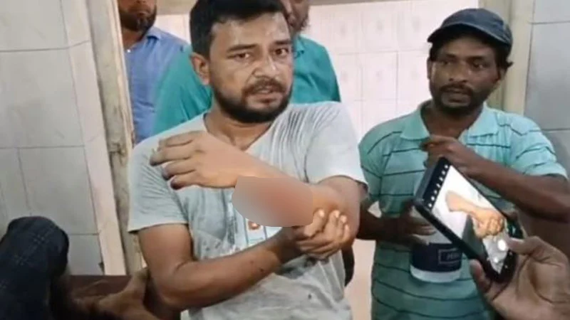 কুমিল্লায় মাছ ধরা নিয়ে দু’পক্ষের সংঘর্ষে গুলিবিদ্ধ ৪